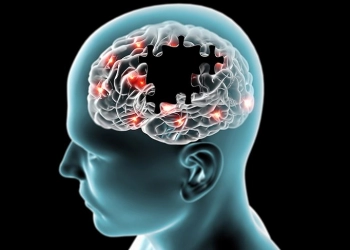 Alzheimer Hastalığında Ozon Tedavisi